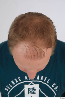 Photos of Jameson Hahn hair head 0006.jpg